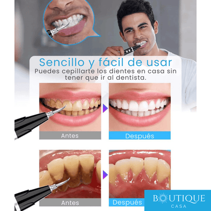 Limpiador Dental Ultrasónico | UltraClean™